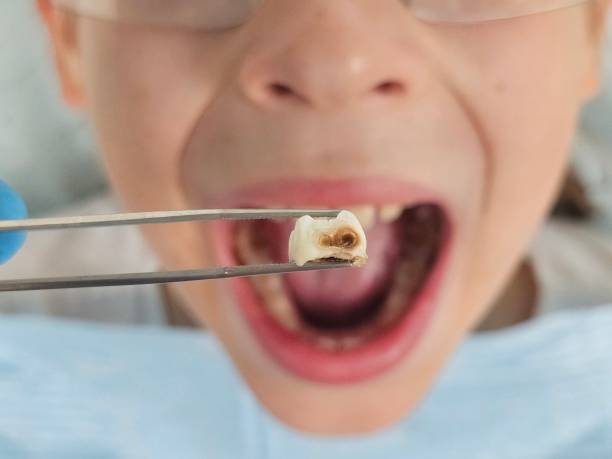 Best Emergency TMJ Treatment in Duryea, PA